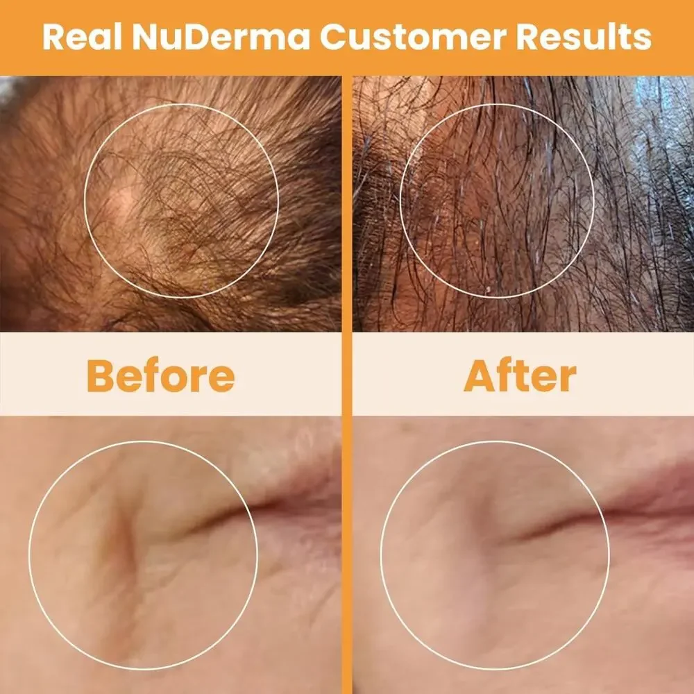 NIB! Pure Daily Care NuDerma Handheld Skin Therapy Wand Machine Anti-Aging
